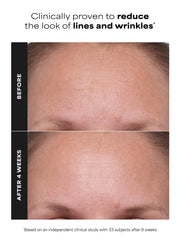 1% Retinol Treatment